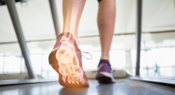 Stock Image of a Foot and Ankle in Motion on a Treadmill